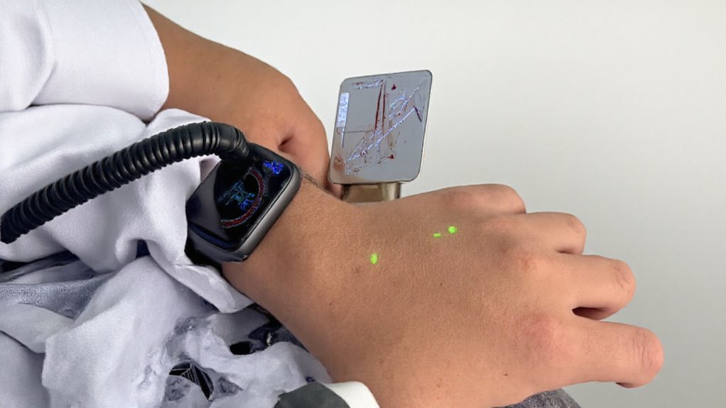 śledzenie ciśnienia krwi za pomocą Apple Watch